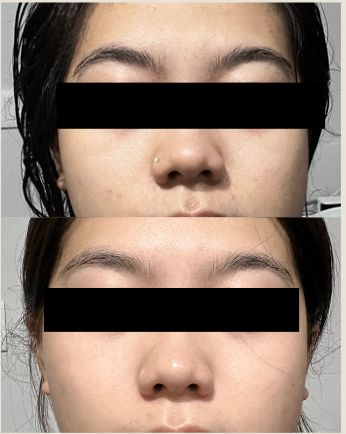 Customer photo review of CLEF Ocean Elixir Multi-Algae Hydrating Toner (120ml)