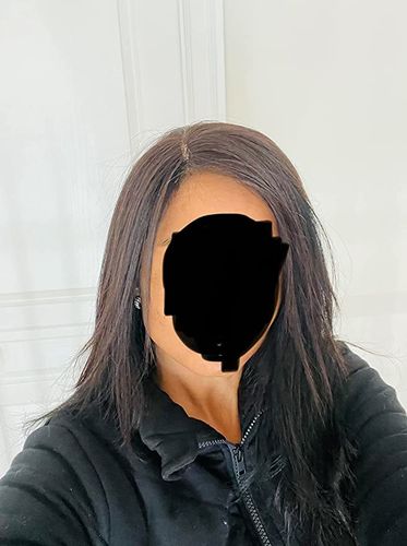 Customer photo review of Moresoo Topper Remy Real Human Hair Pieces Dark Brown(#2)