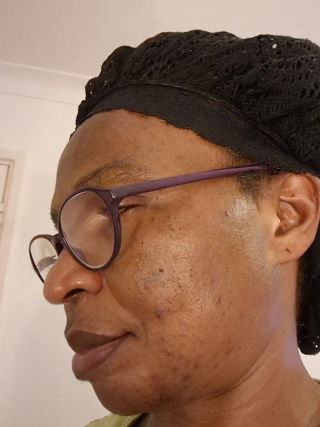 Customer photo review of Kojic Acid  Brightening Serum