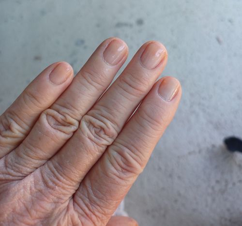 Customer photo review of Rocket Nail Fuel Nail Repair - Clear