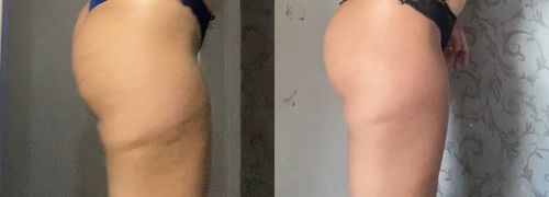 Customer photo review of Bumbum Cream 200g