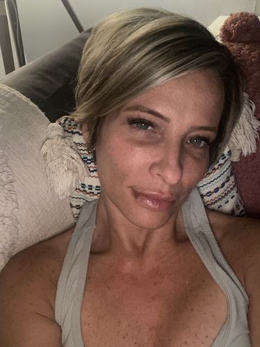 Customer photo review of LipFix: Filler
