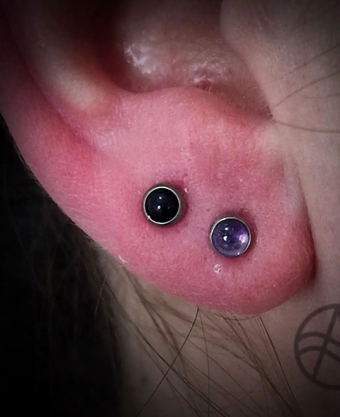 Customer photo review of Piercing Aftercare Straight Shooter Kit