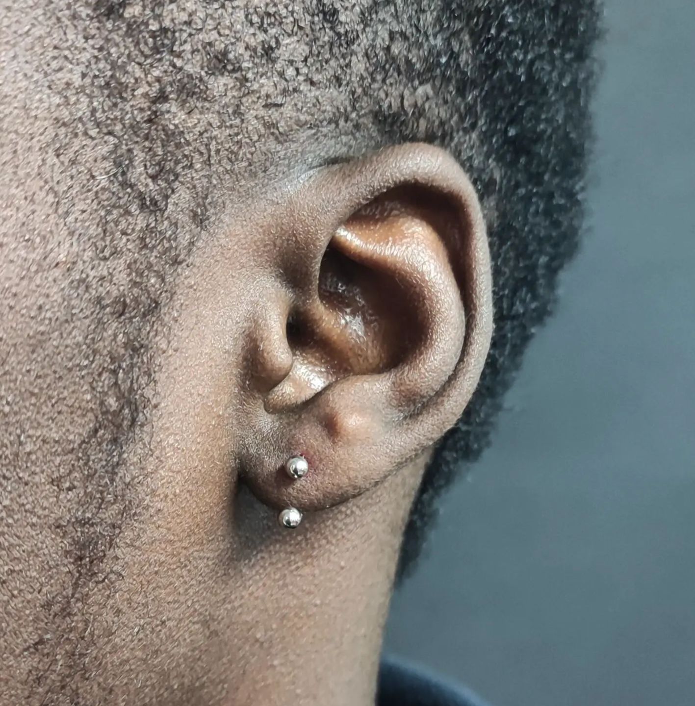 Customer photo review of Piercing Aftercare Straight Shooter Kit