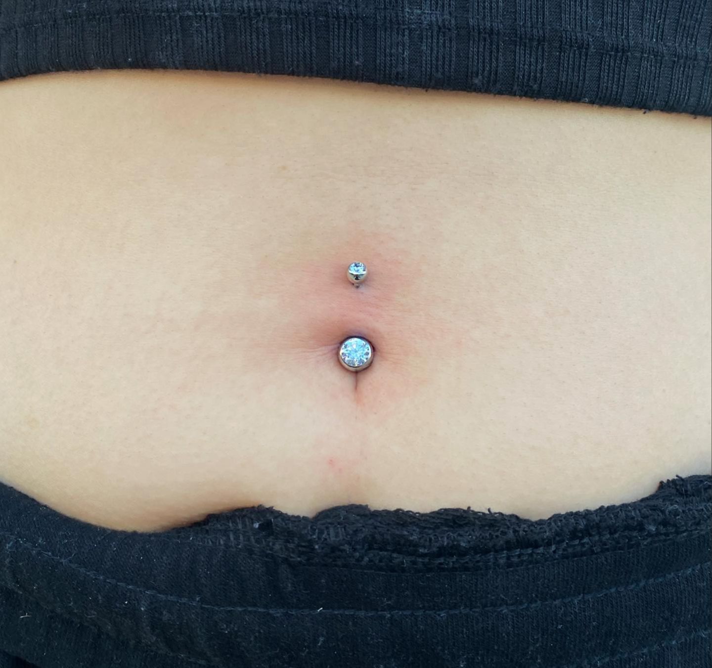 Customer photo review of Piercing Aftercare Straight Shooter Kit