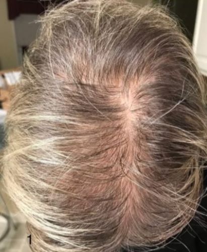 Customer photo review of TOKUGOME Japan Rice Water Hair Serum Mist（Limited time discount 🔥 last day）