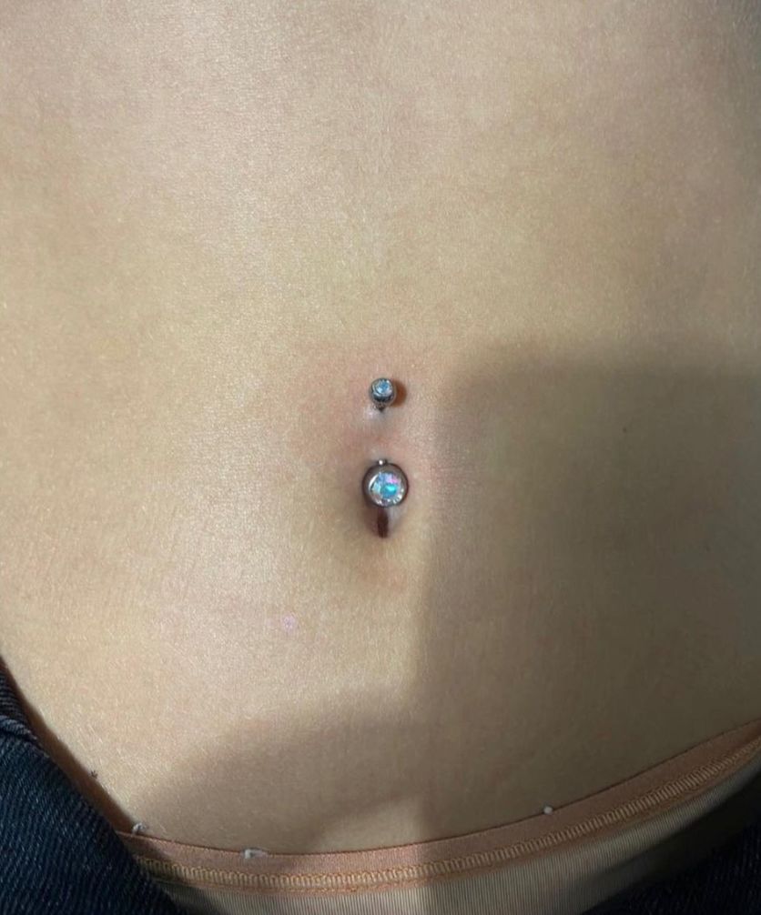 Customer photo review of Piercing Aftercare Keloid Crasher Kit