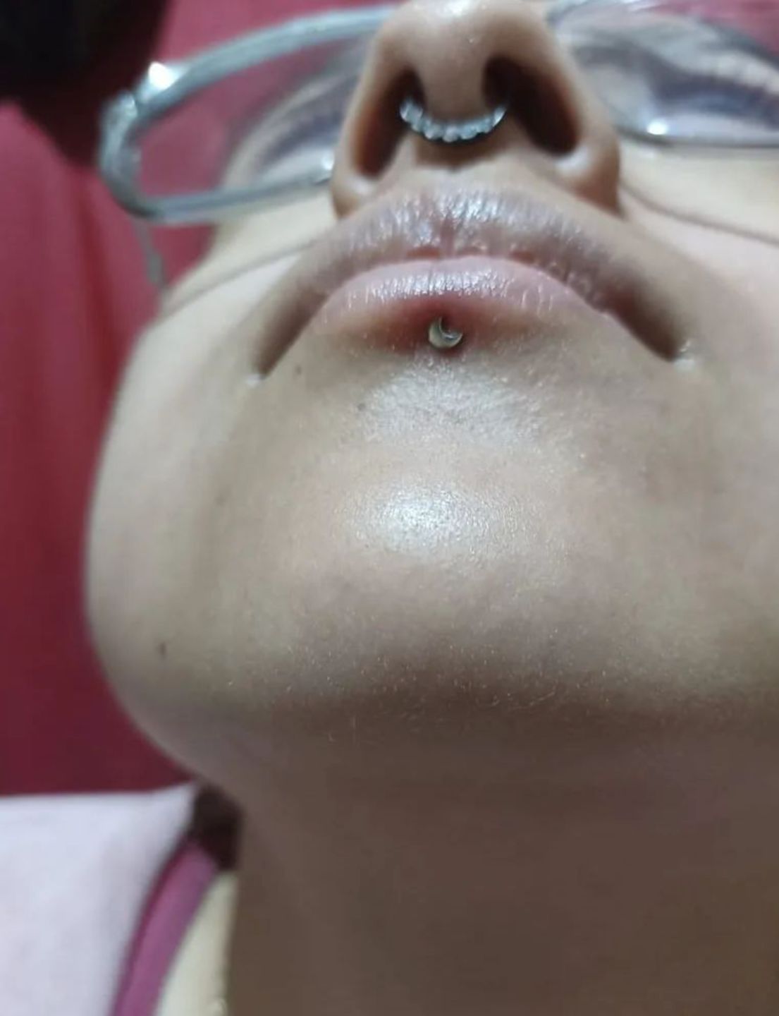 Customer photo review of Piercing Aftercare Straight Shooter Kit