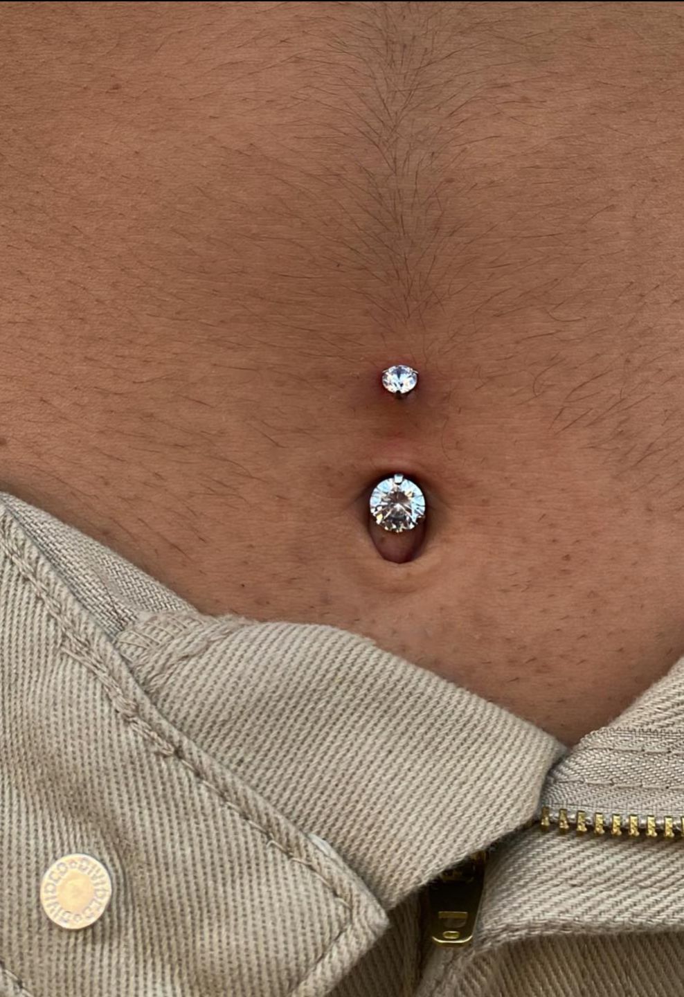 Customer photo review of Piercing Aftercare Straight Shooter Kit