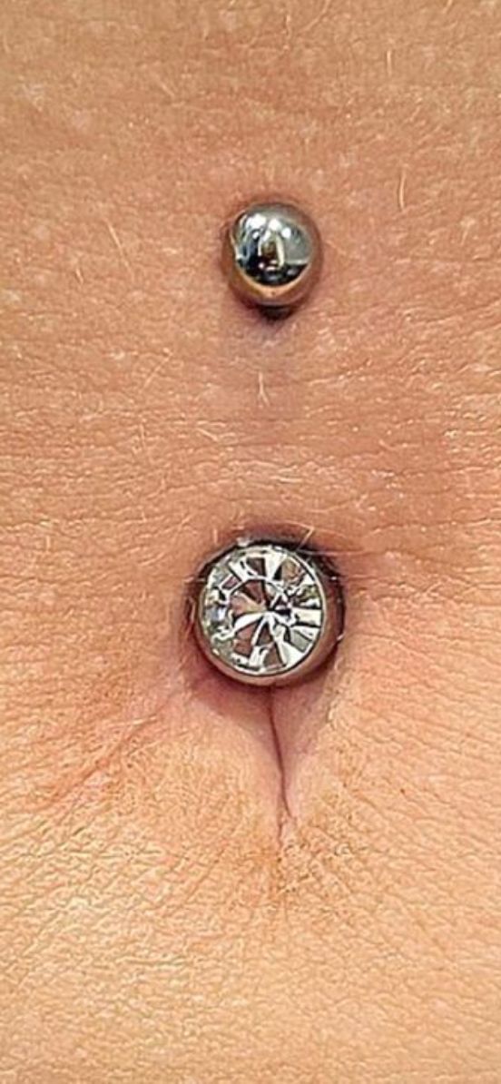 Customer photo review of Piercing Bump Treatment - Bump, Keloid & Scar Relief Oil