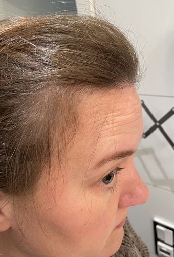 Customer photo review of Pre-Wash Scalp Oil by TR