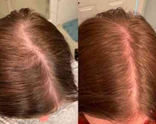 Customer photo review of TOKUGOME Japan Rice Water Hair Serum Mist（Limited time discount 🔥 last day）