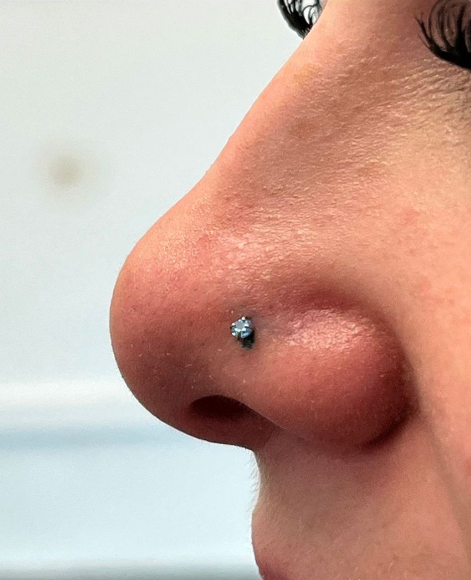 Customer photo review of Piercing Bump Treatment - Bump, Keloid & Scar Relief Oil