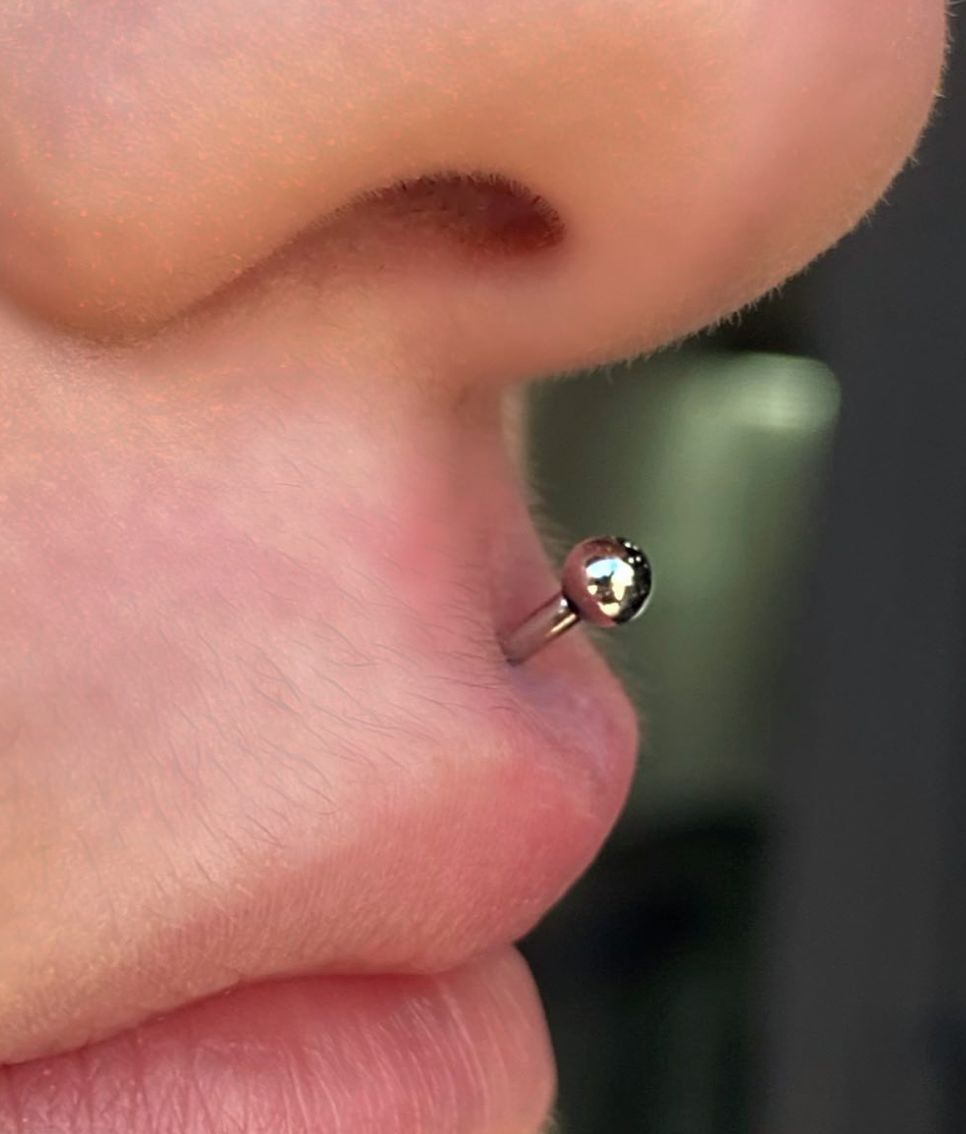 Customer photo review of Piercing Aftercare Keloid Crasher Kit