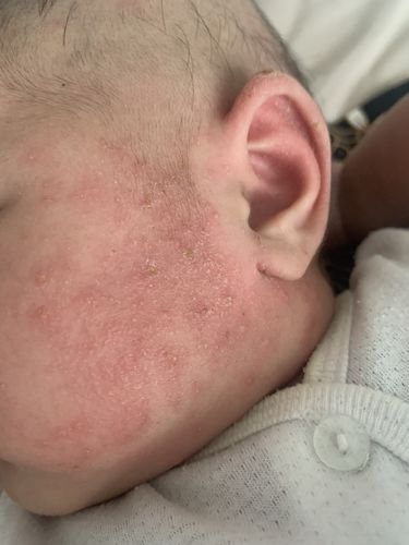 Customer photo review of Jolicare Cream
