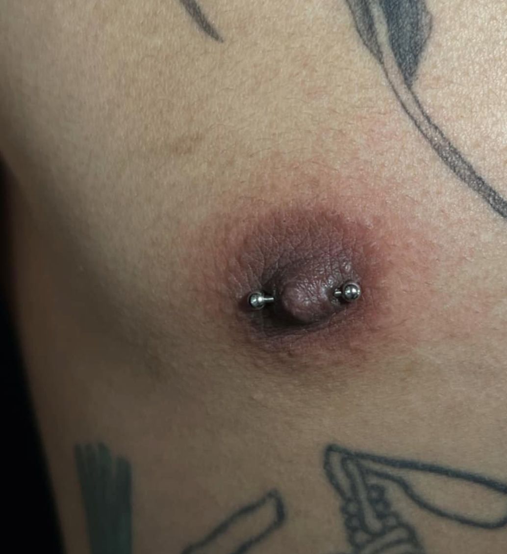 Customer photo review of Piercing Aftercare Spray - Soothes & Cleanses All Piercing Types   - 4oz