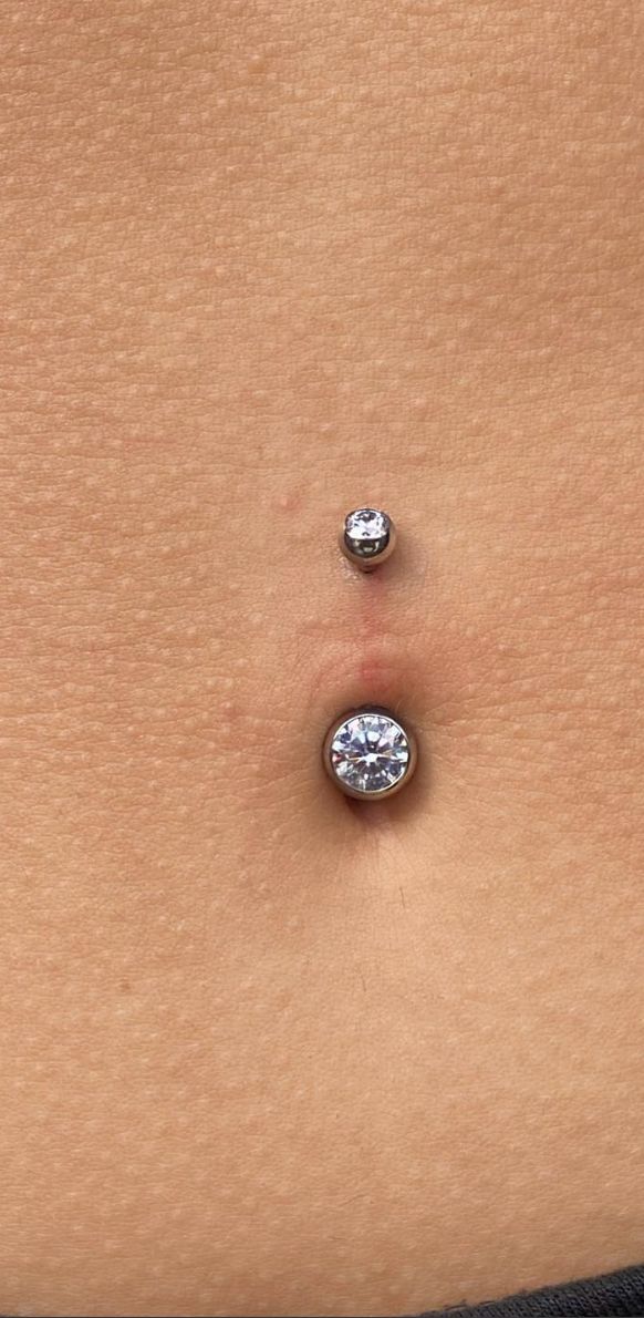 Customer photo review of Piercing Aftercare Keloid Crasher Kit