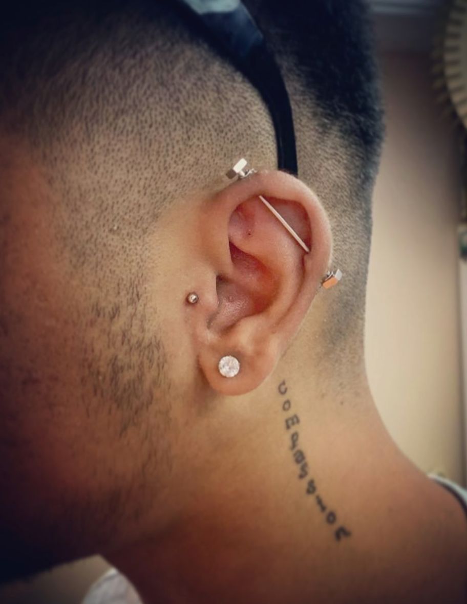 Customer photo review of Piercing Aftercare Keloid Crasher Kit