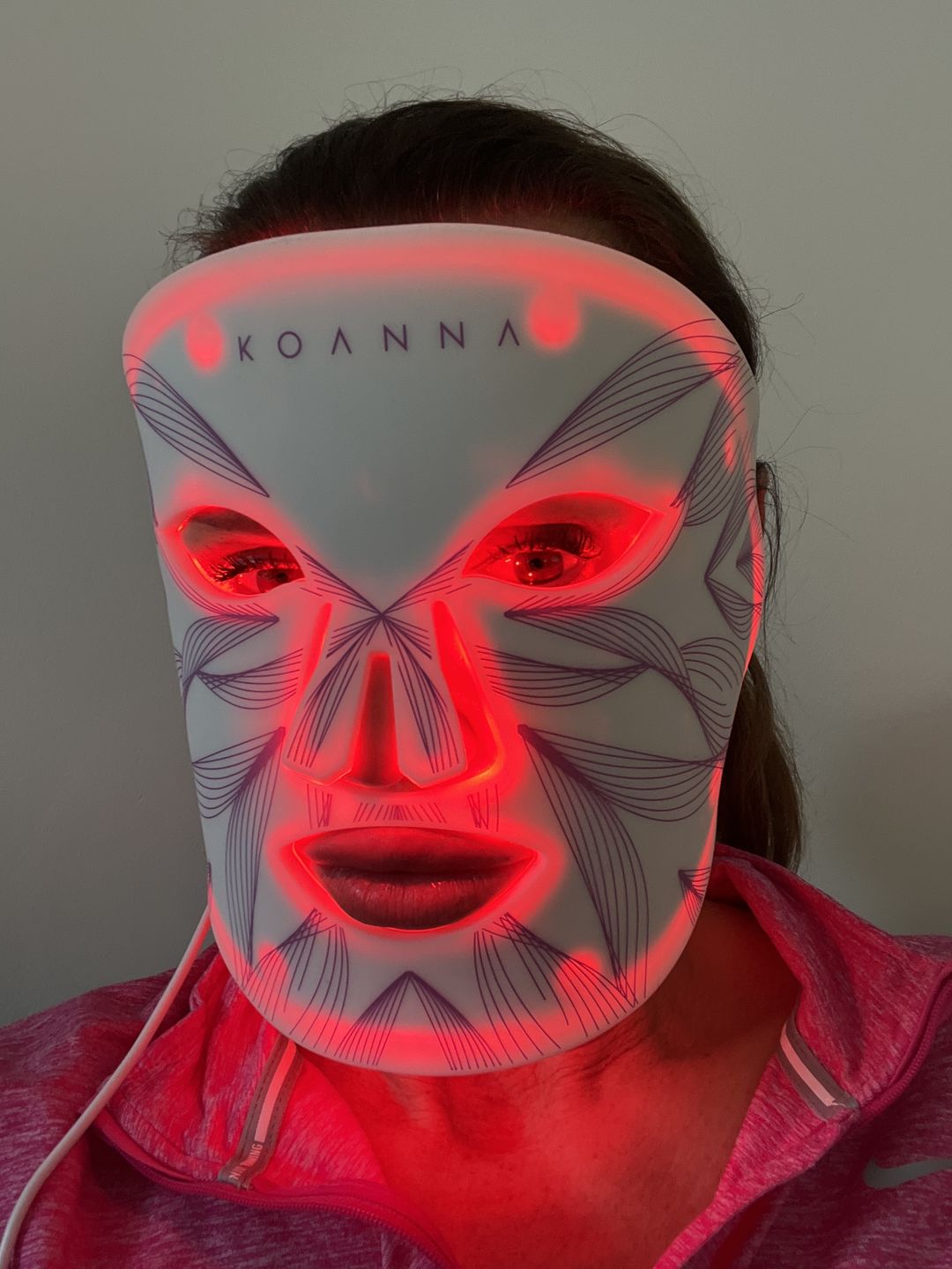 Customer photo review of LED Light Therapy Mask