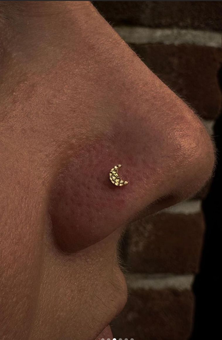 Customer photo review of Piercing Aftercare Spray - Soothes & Cleanses All Piercing Types   - 4oz