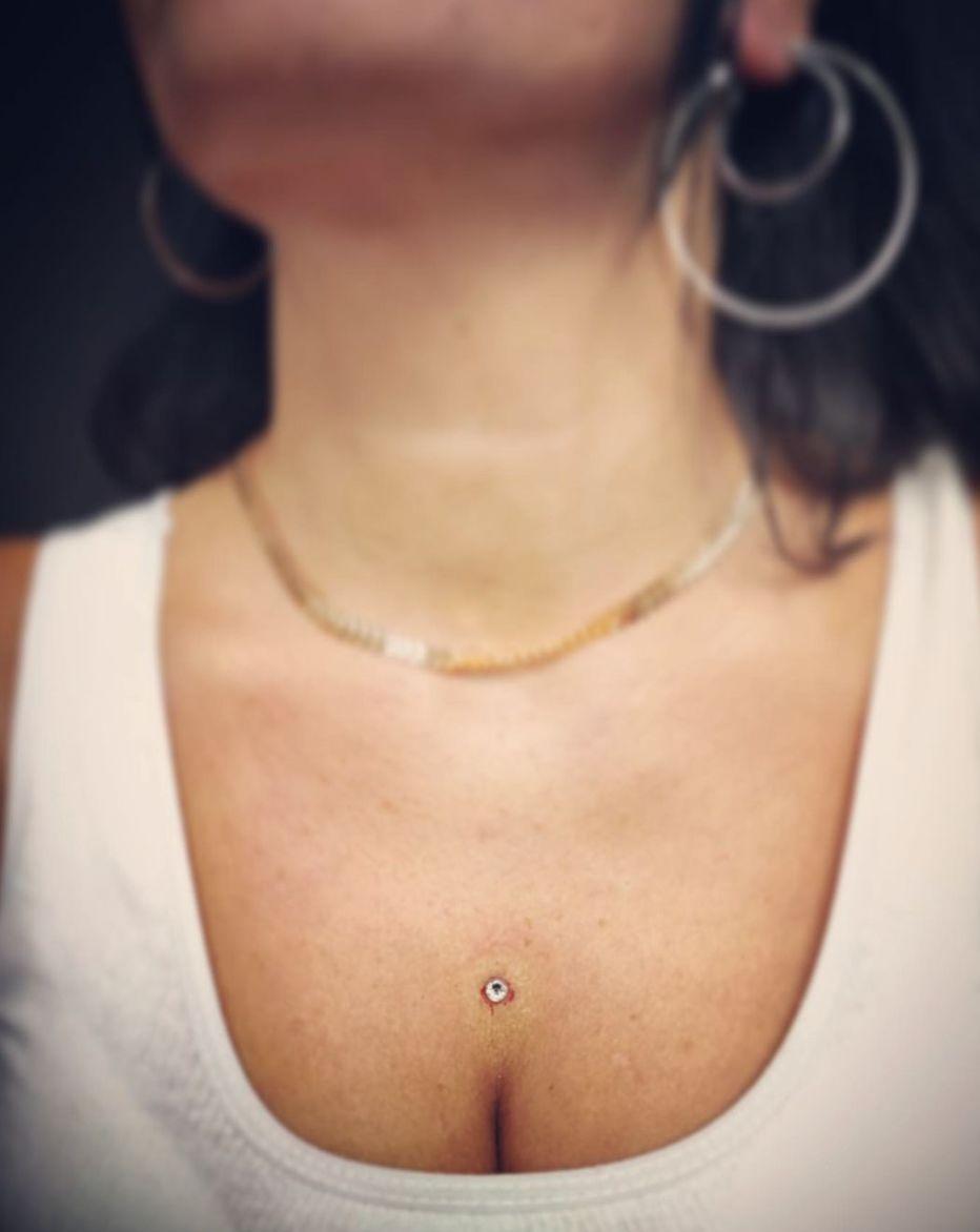 Customer photo review of Piercing Aftercare Keloid Crasher Kit