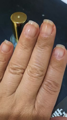 Customer photo review of Rocket Nail Fuel Starter Kit