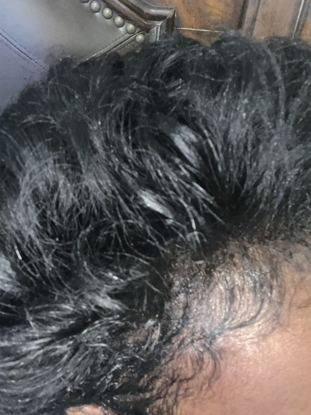 Customer photo review of Super G  Vital Growth Serum Water-based scalp serum infused with white willow bark