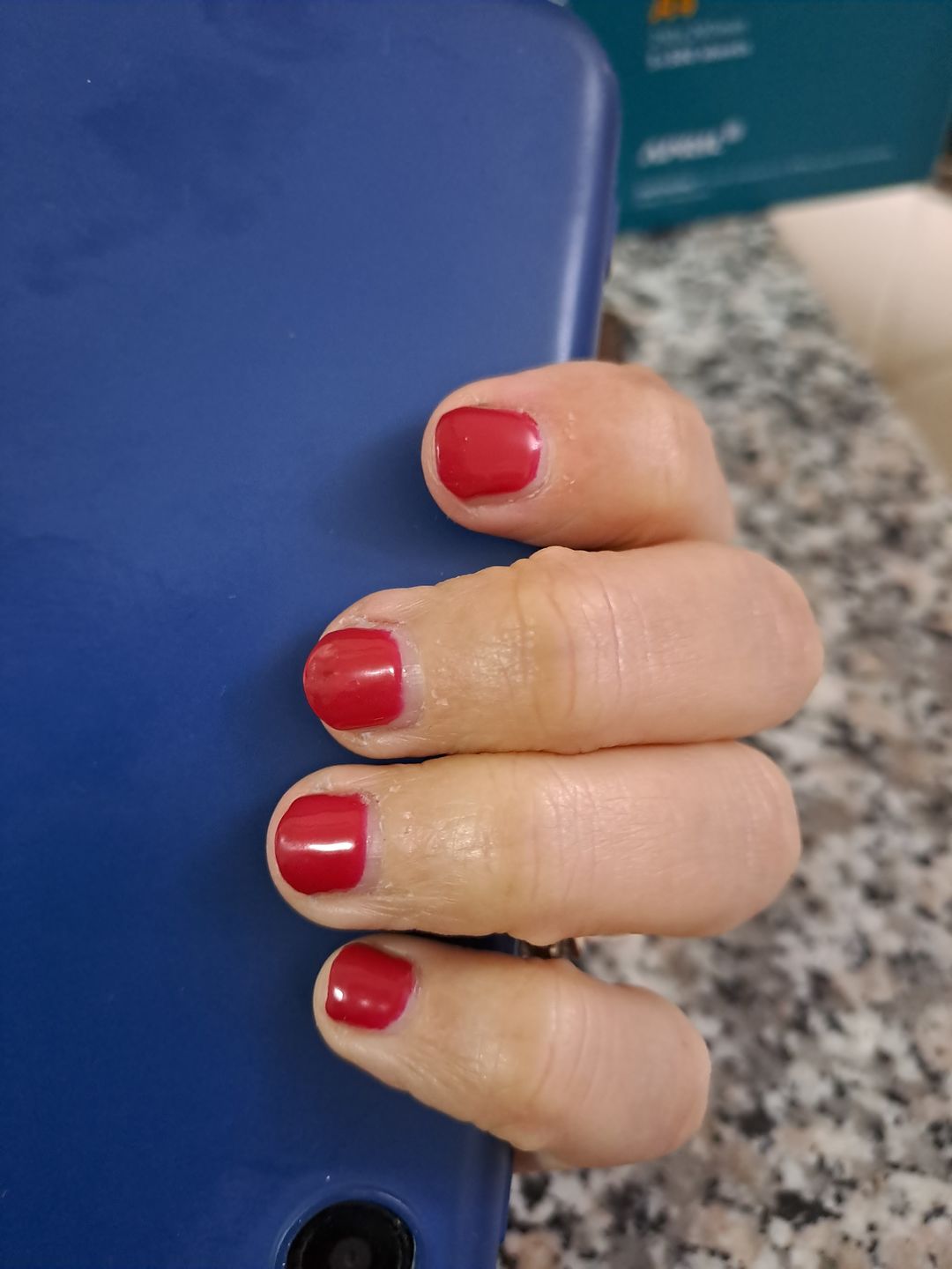 Customer photo review of LCI Combo Pack: Base Coat 10 ml + Top Coat 10 ml