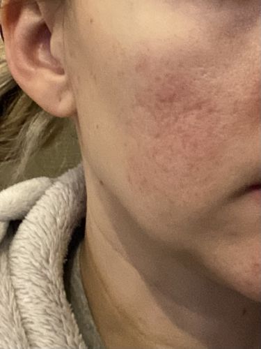 Customer photo review of Cleansing Oil