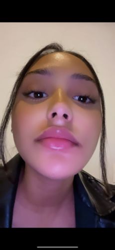 Customer photo review of LipFix: Filler