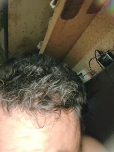 Customer photo review of Alpecin Caffeine Shampoo C1 (250ml) - Gold Limited Edition