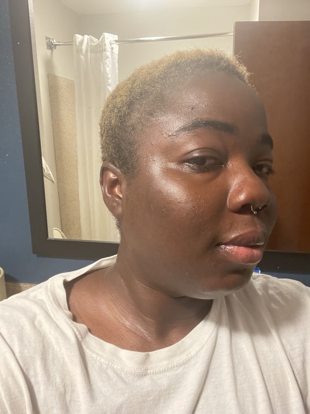 Customer photo review of Turmeric face wash for black spots,acne & glow