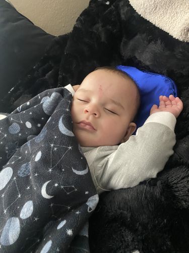 Customer photo review of 2 in 1 Head Shaping and Hair Saving Pillow