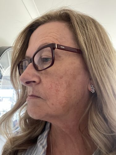 Customer photo review of Naked Skin™ Handset