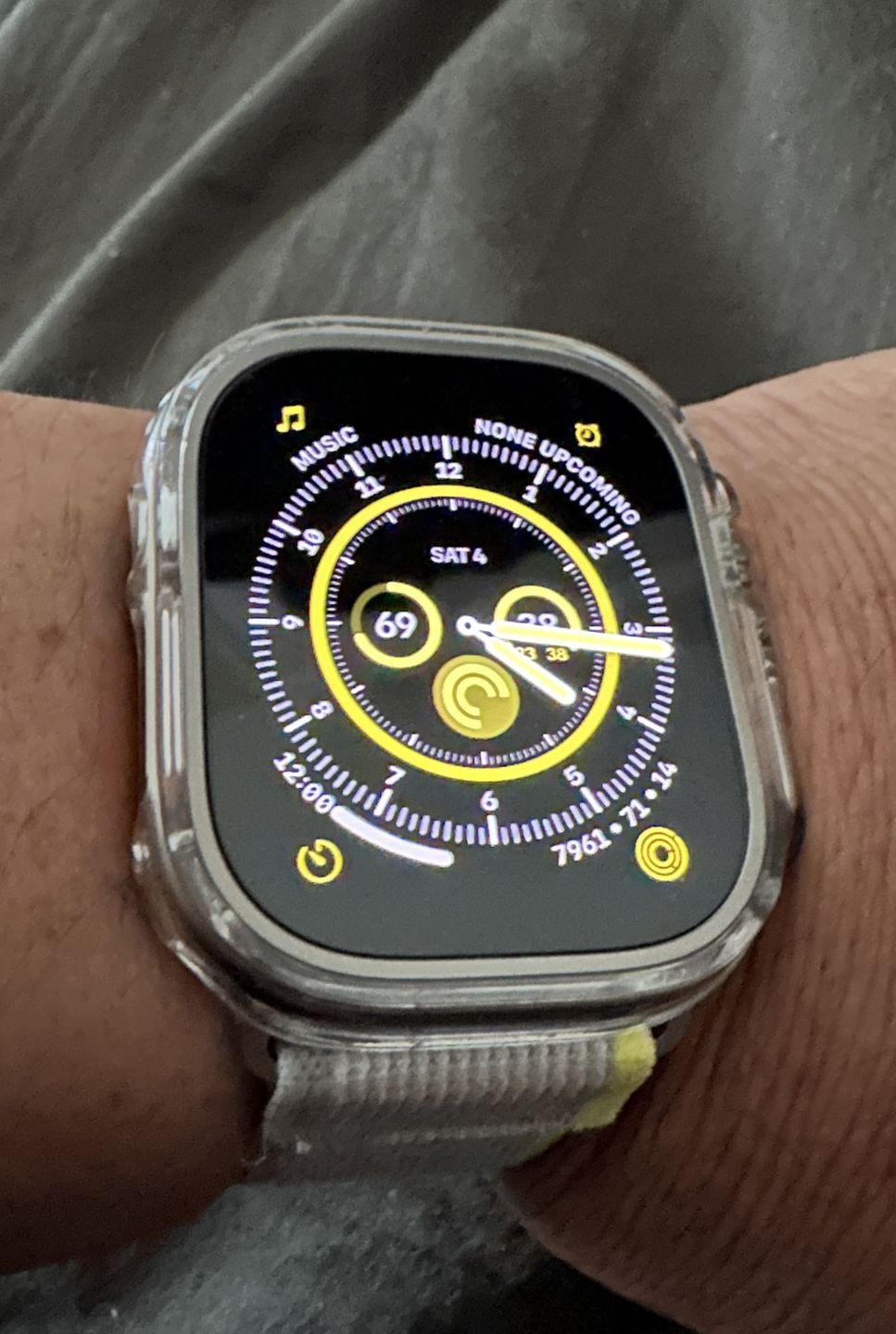 Customer photo review of Trail Loop Apple Watch Band