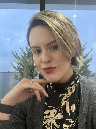 Customer photo review of KIT SERUMS FACIAL DIA Y NOCHE  CON CÉLULAS MADRE, COLÁGENO Y ÁCIDO HIALURÓNICO