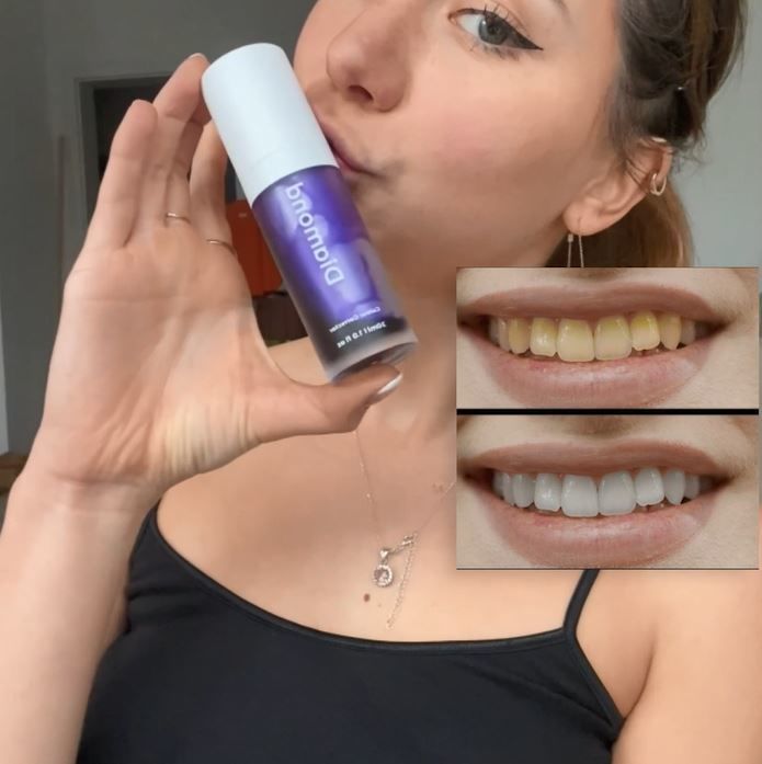 Customer photo review of Zahnbleaching Farbkorrektur Serum