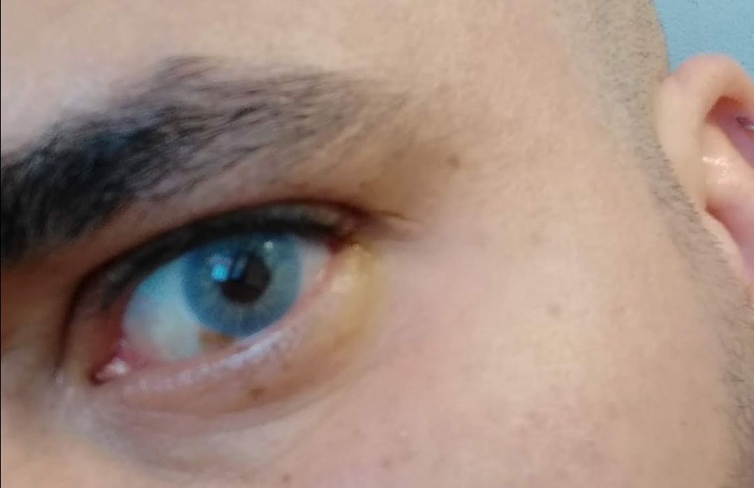 Customer photo review of Siesta Original Aqua