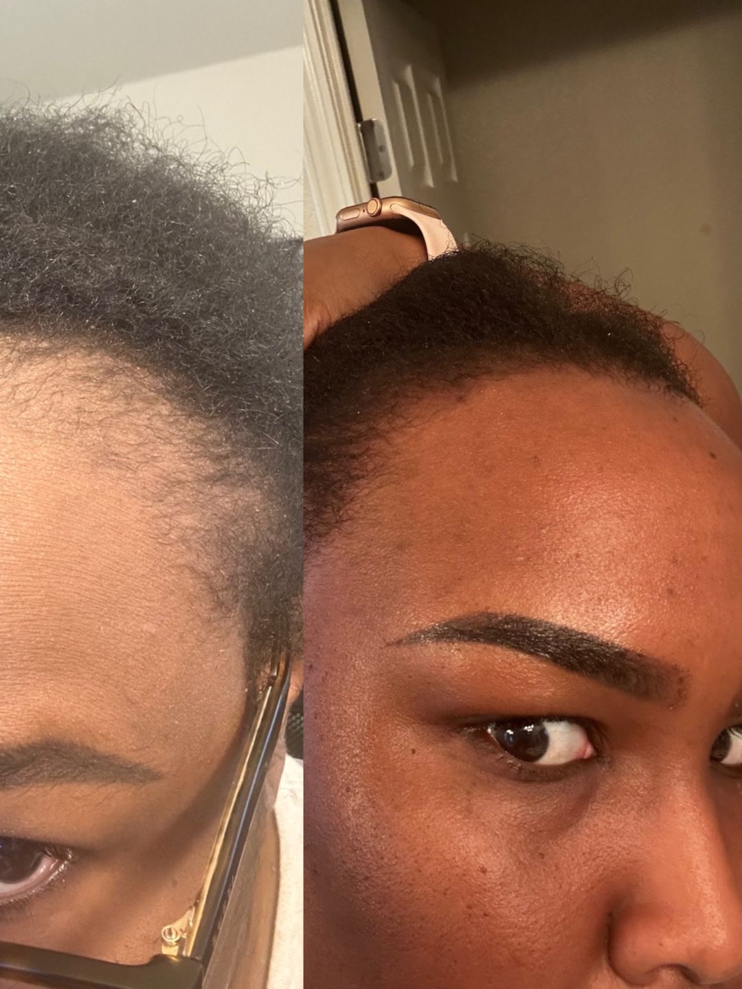 Customer photo review of Hair Growth Oil