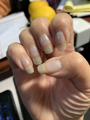 Customer photo review of Route Package Protection