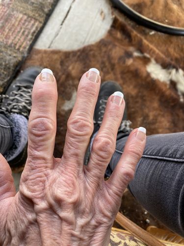 Customer photo review of Rocket Nail Fuel Nail Repair - Clear