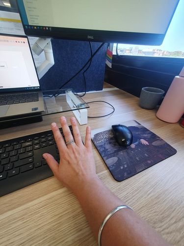 Customer photo review of Stacked Fidget Anxiety Ring Adjustable