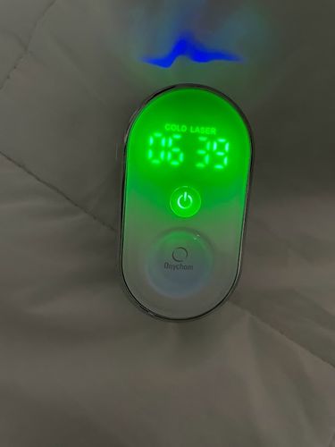 Customer photo review of Onychom - Antifungal Laser Device