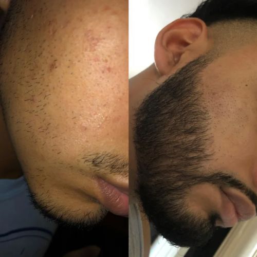 Customer photo review of Beard Care Pack