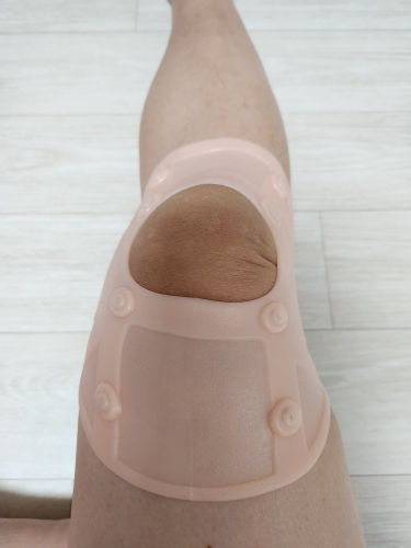 Customer photo review of OsteoGuard™ Skyddskuddar för artros