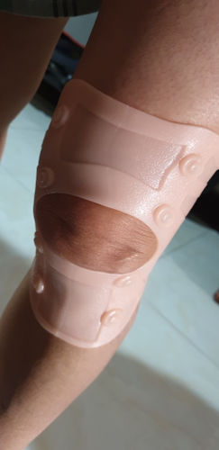 Customer photo review of OsteoGuard™ Skyddskuddar för artros