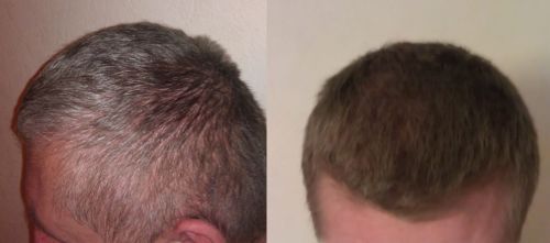 Customer photo review of Beard Care Pack