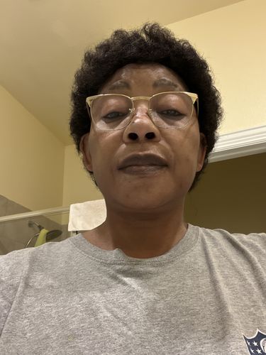 Customer photo review of NEW Forever Pink: Lightening Scrub & Balm (For Lips)