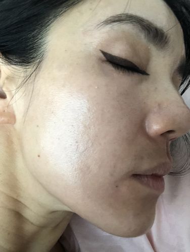 Customer photo review of Niacid