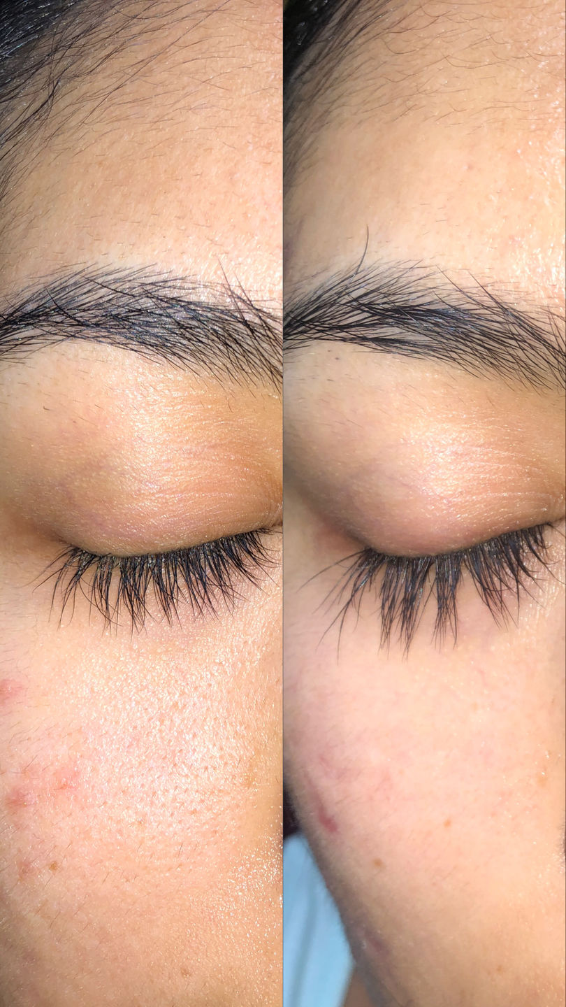 Customer photo review of fLASH Eyelash Serum
